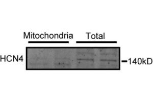 Western blot analysis of rat SANPC mitochondria showing total and mitochondrial protein expression of HCN4.