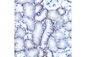 Immunohistochemistry of paraffin-embedded mouse kidney using EXTL3 Rabbit pAb (ABIN1679782, ABIN3018195, ABIN3018196 and ABIN6220395) at dilution of 1:100 (40x lens). (EXTL3 antibody  (AA 52-220))