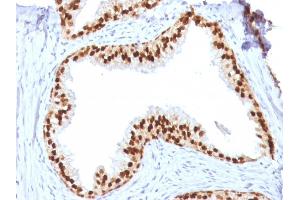 Formalin-fixed, paraffin-embedded human Prostate stained with FOXA1 Mouse Monoclonal Antibody (FOXA1/1512). (FOXA1 antibody  (AA 372-472))