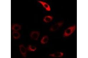 Immunofluorescent analysis of TGase5 staining in U2OS cells. (Transglutaminase 5 antibody)