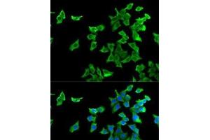 Immunofluorescence analysis of U2OS cells using HTR2B Polyclonal Antibody (Serotonin Receptor 2B antibody)