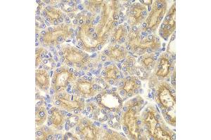 Immunohistochemistry of paraffin-embedded rat kidney using PAK1 antibody. (PAK1 antibody)