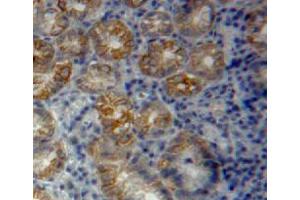Used in DAB staining on fromalin fixed paraffin-embedded stomach tissue (Vinculin antibody  (AA 1020-1134))