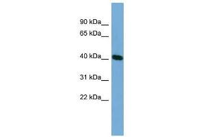 Western Blot showing TSSK2 antibody used at a concentration of 1-2 ug/ml to detect its target protein. (TSSK2 antibody  (Middle Region))