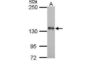 WB Image Sample (30 ug of whole cell lysate) A: H1299 5% SDS PAGE antibody diluted at 1:500 (AXL antibody  (C-Term))
