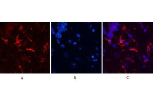 Immunofluorescence analysis of mouse brain tissue. (GFAP antibody)