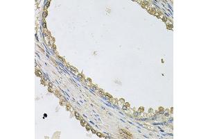 Immunohistochemistry of paraffin-embedded human prostate using MTERFD1 antibody. (MTERFD1 antibody)