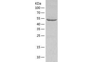 IMPDH1 Protein (AA 1-514) (His tag)