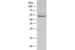 Western Blotting (WB) image for Inosine 5'-Phosphate Dehydrogenase 1 (IMPDH1) (AA 1-514) protein (His tag) (ABIN7123435) (IMPDH1 Protein (AA 1-514) (His tag))