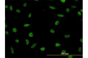 Immunofluorescence of monoclonal antibody to LDB2 on HeLa cell. (LIM Domain Binding 2 Protein antibody  (AA 1-373))