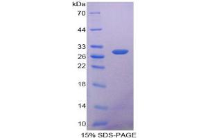 SDS-PAGE analysis of Human ANP32A Protein. (PHAP1 Protein)