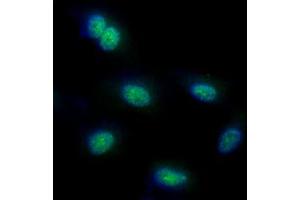 ICC/IF analysis of FUBP1 in HeLa cells line, stained with DAPI (Blue) for nucleus staining and monoclonal anti-human FUBP1 antibody (1:100) with goat anti-mouse IgG-Alexa fluor 488 conjugate (Green). (FUBP1 antibody)