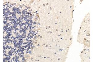 ABIN6265856 and ABIN6279905 at 1/100 staining Rat brain tissue by IHC-P.