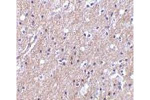 Immunohistochemistry of CTRP6 in human brain tissue with CTRP6 antibody at 10 μg/ml. (CTRP6 antibody  (Intermediate Domain))