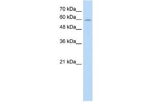WB Suggested Anti-ANAPC7 Antibody Titration:  0. (ANAPC7 antibody  (C-Term))
