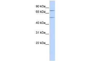WB Suggested Anti-ZNF582 Antibody Titration:  0. (ZNF582 antibody  (N-Term))