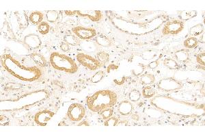 Detection of CR1 in Human Kidney Tissue using Polyclonal Antibody to Complement Receptor 1, Erythrocyte (CR1) (CD35 antibody  (AA 1780-2039))