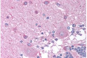 Human Brain, Cerebellum (formalin-fixed, paraffin-embedded) stained with CHRNB2 antibody ABIN214742 at 10 ug/ml followed by biotinylated goat anti-rabbit IgG secondary antibody ABIN481713, alkaline phosphatase-streptavidin and chromogen. (CHRNB2 antibody  (AA 21-70))