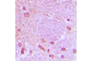 Immunohistochemical analysis of TCF3 staining in human brain formalin fixed paraffin embedded tissue section. (TCF3 antibody  (C-Term))