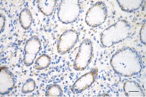 anti-Peroxiredoxin 3 (PRDX3) antibody