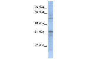 MTCH2 antibody used at 1 ug/ml to detect target protein. (MTCH2 antibody)