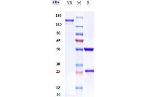 Anti-ROR1 Reference Antibody (zilovertamab) on SDS-PAGE under reducing (R) condition. (Recombinant ROR1 (Zilovertamab Biosimilar) antibody)