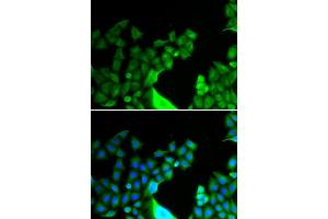 Immunofluorescence analysis of HeLa cell using BCL2L14 antibody.
