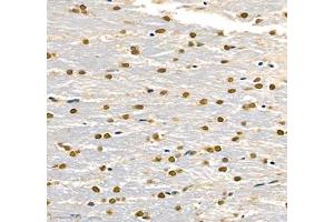 Immunohistochemistry (Paraffin-embedded Sections) (IHC (p)) image for anti-Transketolase (TKT) antibody (ABIN7075978)