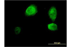 Immunofluorescence of monoclonal antibody to ING3 on HeLa cell.