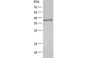 Western Blotting (WB) image for tyrosyl-DNA phosphodiesterase 2 (TDP2) (AA 1-362) protein (His tag) (ABIN7125568) (TDP2 Protein (AA 1-362) (His tag))