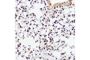 Immunohistochemistry of paraffin-embedded mouse lung using WBP11 Rabbit pAb (ABIN7271390) at dilution of 1:100 (40x lens). (WBP11 antibody  (AA 1-140))