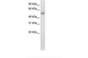 Image no. 2 for anti-Methyltransferase Like 3 (METTL3) (N-Term) antibody (ABIN202783) (METTL3 antibody  (N-Term))