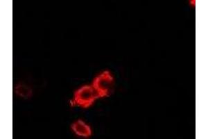 Immunofluorescent analysis of OGT staining in U2OS cells. (OGT antibody)