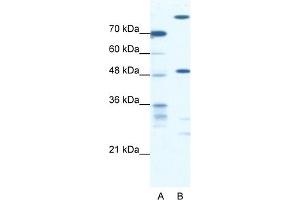 WB Suggested Anti-NFS1 Antibody Titration:  0. (NFS1 antibody  (Middle Region))