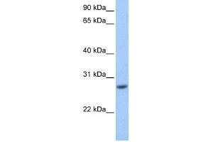 WB Suggested Anti-GSTM3 Antibody Titration: 0. (GSTM3 antibody  (Middle Region))