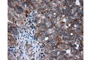 Immunohistochemical staining of paraffin-embedded Kidney tissue using anti-AKR1A1 mouse monoclonal antibody. (AKR1A1 antibody)