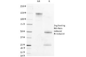 SDS-PAGE Analysis Purified AFP Mouse Monoclonal Antibody (MBS-12). (alpha Fetoprotein antibody)