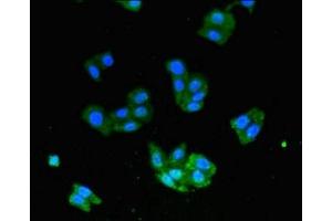 Immunofluorescent analysis of HepG2 cells using ABIN7174316 at dilution of 1:100 and Alexa Fluor 488-congugated AffiniPure Goat Anti-Rabbit IgG(H+L) (USP33 antibody  (C-Term))