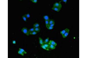 Immunofluorescent analysis of HepG2 cells using ABIN7174316 at dilution of 1:100 and Alexa Fluor 488-congugated AffiniPure Goat Anti-Rabbit IgG(H+L) (USP33 antibody  (C-Term))