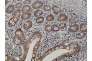 Immunoperoxidase of monoclonal antibody to TYK2 on formalin-fixed paraffin-embedded human small Intestine. (TYK2 antibody  (AA 276-375))