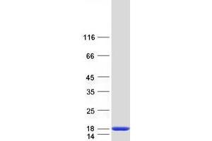 Western Blotting (WB) image for Translocase of Inner Mitochondrial Membrane 13 Homolog (TIMM13) protein (Myc-DYKDDDDK Tag) (ABIN2733740)