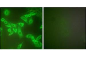 Immunofluorescence analysis of A549 cells, using Stefin B antibody (ABIN5976509). (CSTB antibody  (Internal Region))