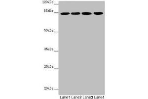Western blot All lanes: LRSAM1 antibody at 2. (LRSAM1 antibody  (AA 1-290))