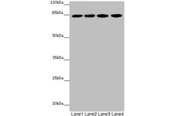 LRSAM1 抗体  (AA 1-290)