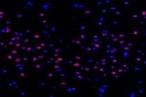 Immunofluorescent analysis of paraformaldehyde-fixed rat striatum using,TCOF1 (ABIN7076003) at dilution of 1: 1400 (TCOF1 antibody)