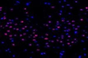 Immunofluorescent analysis of paraformaldehyde-fixed rat striatum using,TCOF1 (ABIN7076003) at dilution of 1: 1400