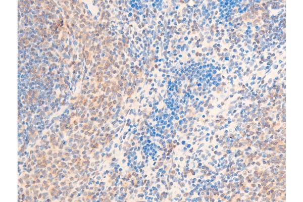 HSPB6 antibody  (pSer16)