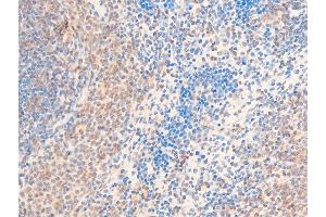 ABIN6267220 at 1/100 staining rat spleen tissue sections by IHC-P.