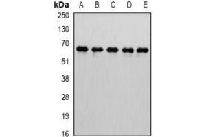 Western blot analysis of MTGR1 expression in Jurkat (A), HepG2 (B), mouse testis (C), mouse kidney (D), rat brain (E) whole cell lysates. (CBFA2T2 antibody)
