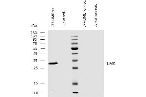 Western blotting analysis of human LIME using mouse monoclonal antibody LIME-10 on lysates of J77-LIME transfectants and Jurkat cells under reducing and non-reducing conditions.